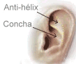 Otoplastia