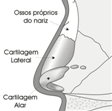 rinoplastia-fig1