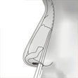 rinoplastia-fig1