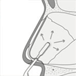 rinoplastia-fig1
