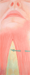 Ritidoplastia